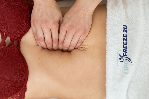 diastasis recti treatment Bridgend