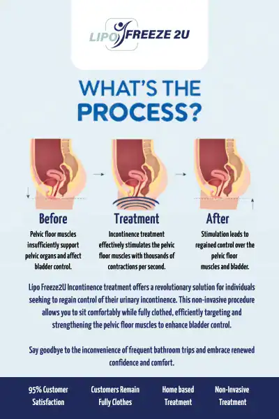 Diagram of how incontinence treatment Bridgend works.