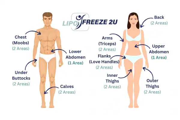 Areas you can have fat freezing treatment Bridgend