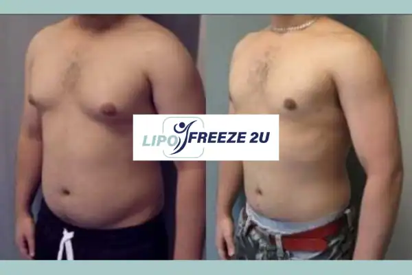 How Long Does It Take to See Results Bridgend?