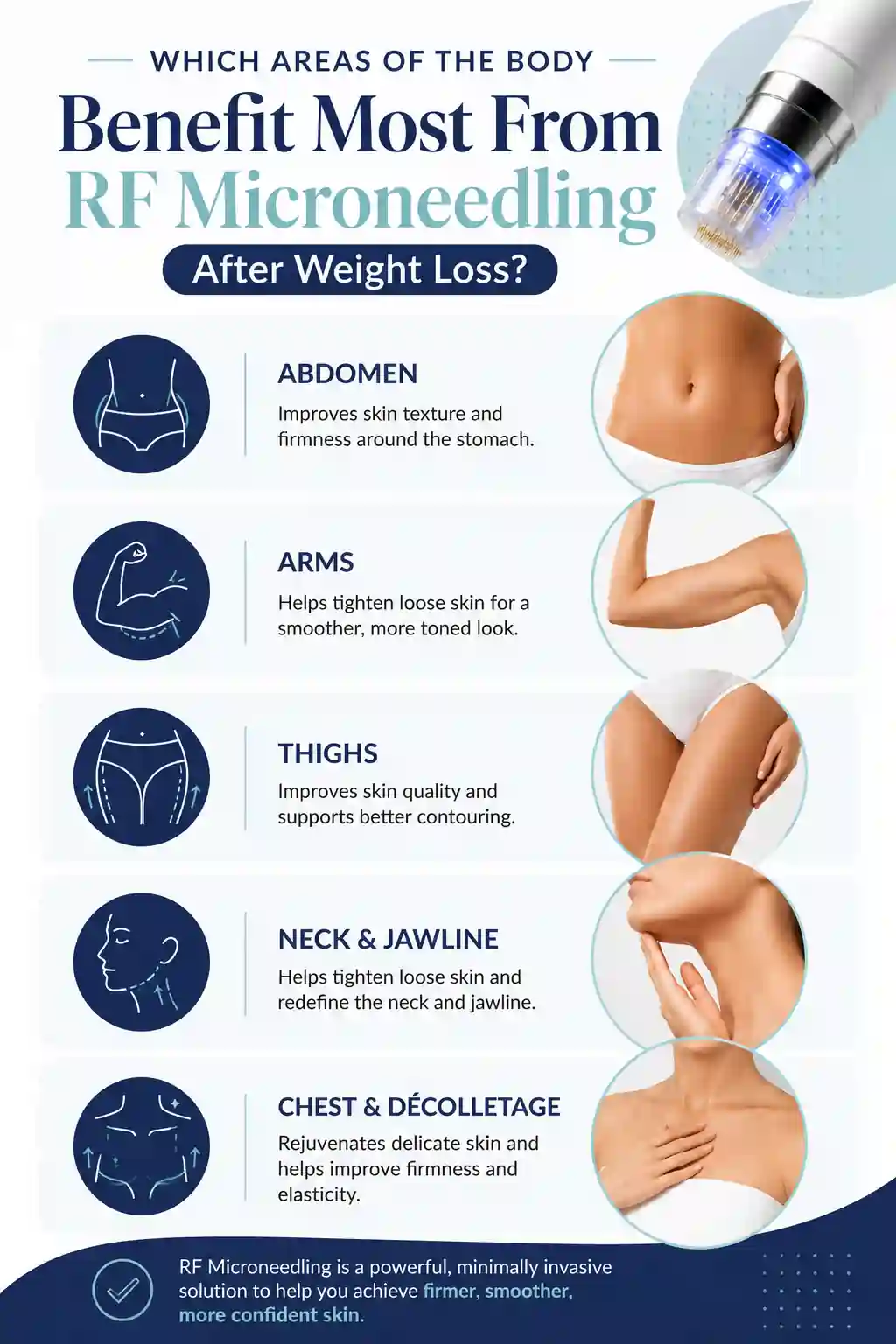 Which Areas of the Body Benefit Most From RF Microneedling After Weight Loss Bridgend
